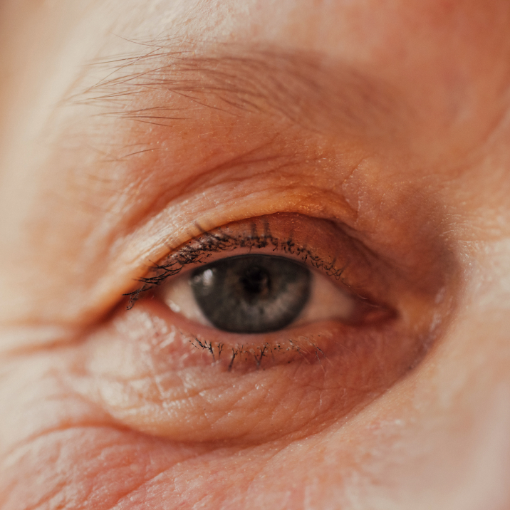 Extreme close-up of an eye with a folded upper eyelid and fine lines around it