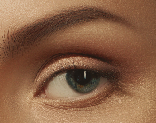 Close-up of an upper eyelid with excess skin resting on the lash line