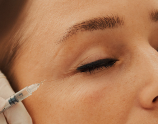 Fine lines fanning out from the outer corner of an eye