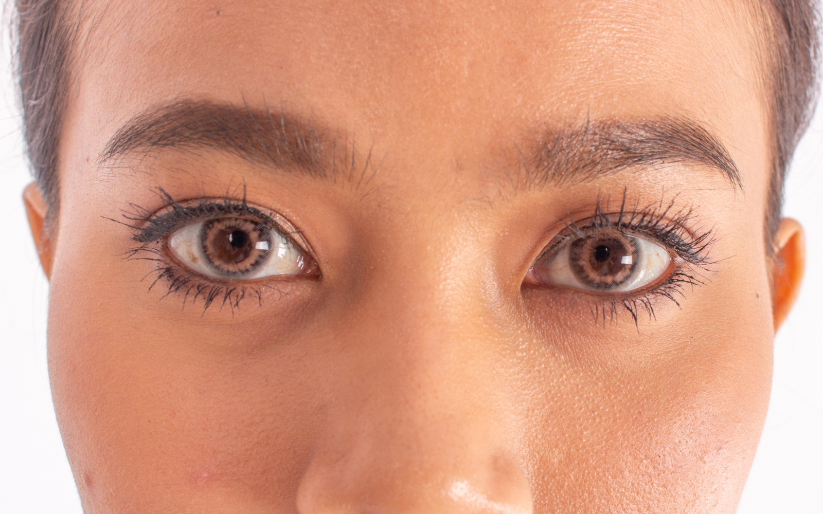 Upper eyelid before blepharoplasty