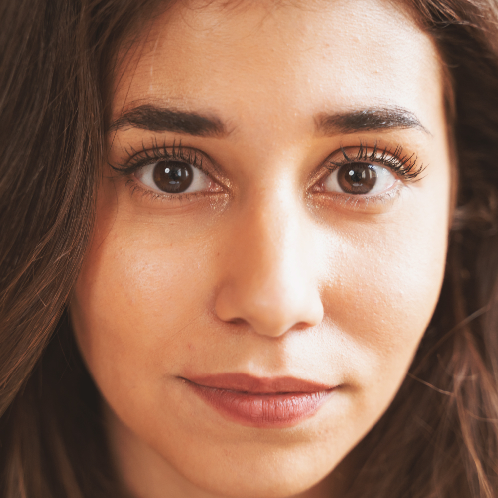 Patient portrait for eyelid revision surgery